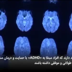 آیا ابتلا به “ADHD” در طول عمر افراد نقش دارد؟ + ویدئو