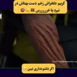 مراحل گریم دلخراش دستِ بهتاش در مبارزه با خرس + ویدئو